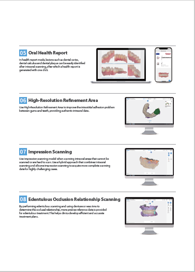 Intraoral scanner Runyes 3DS V5 - Image 4